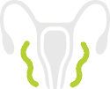 Ovarian Swelling